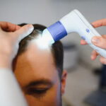 Proses sebelum hair transplant di KAI Hair Clinic